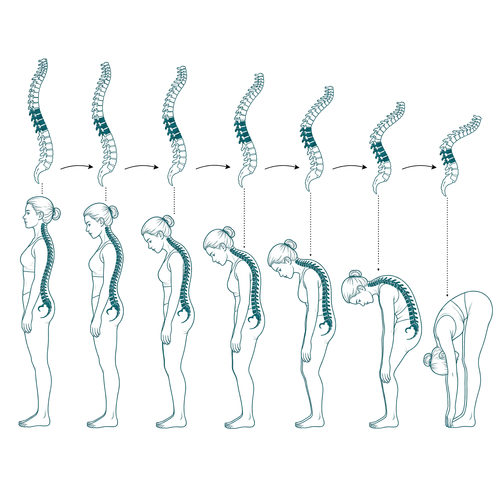 Pilates after Structural Integration